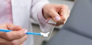 Cluj: Testare gratuită Babeș-Papaniculau și HPV – Află care sunt condițiile